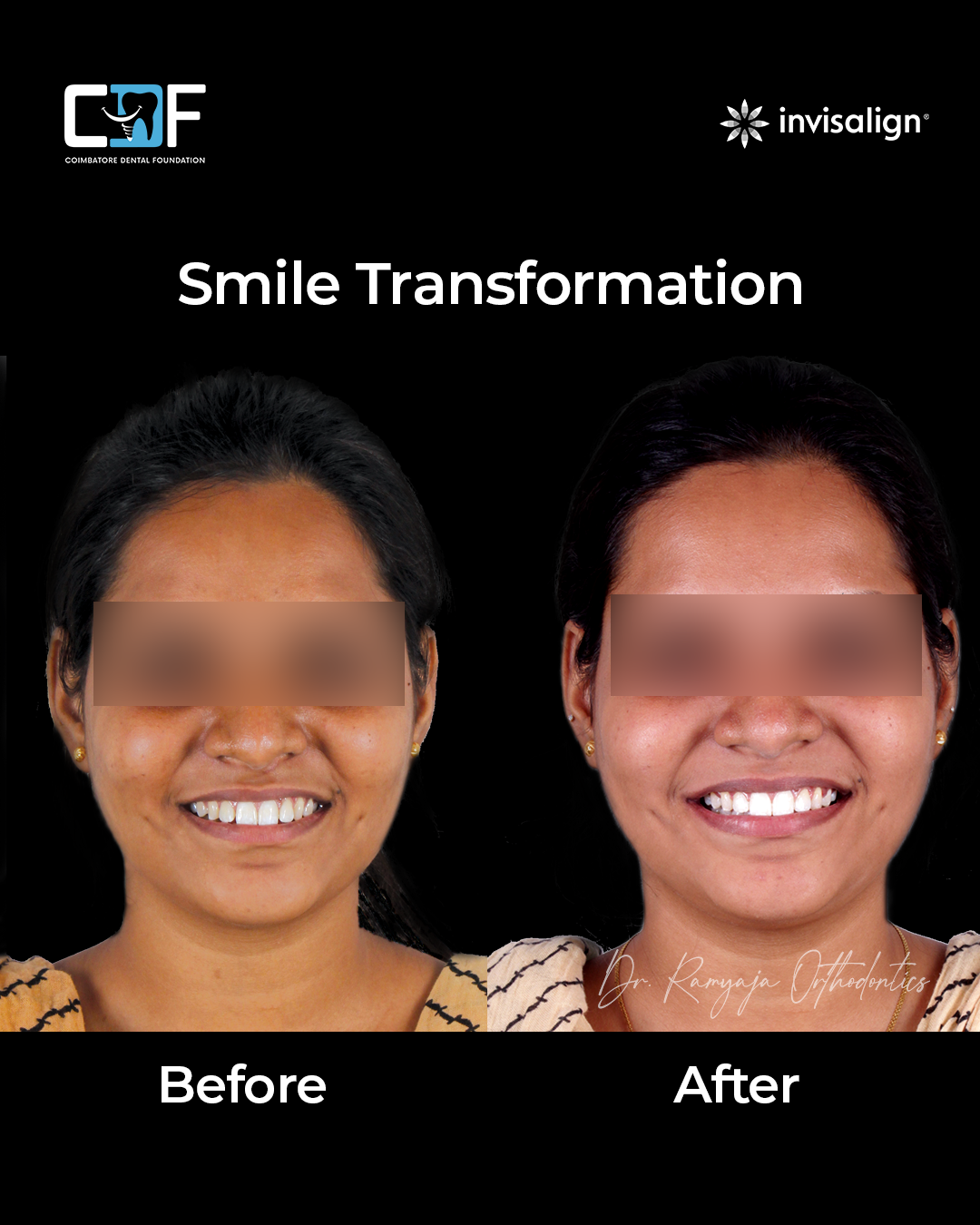 Before After Result